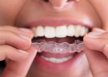 Important things to look at when getting orthodontist treatment