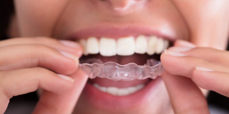 Important things to look at when getting orthodontist treatment