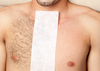 What Are the Different Methods of Body Hair Removal for Men?