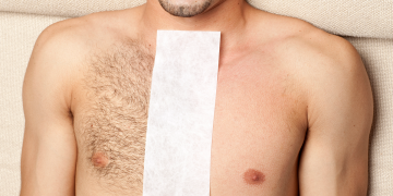What Are the Different Methods of Body Hair Removal for Men?