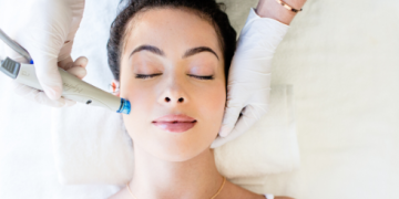 Does Hydrafacial Work for Acne?